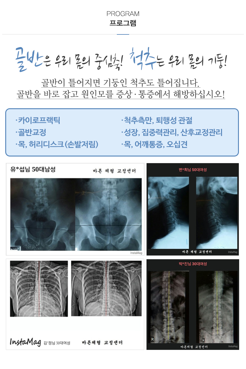 바른체형 골반교정센터_내용